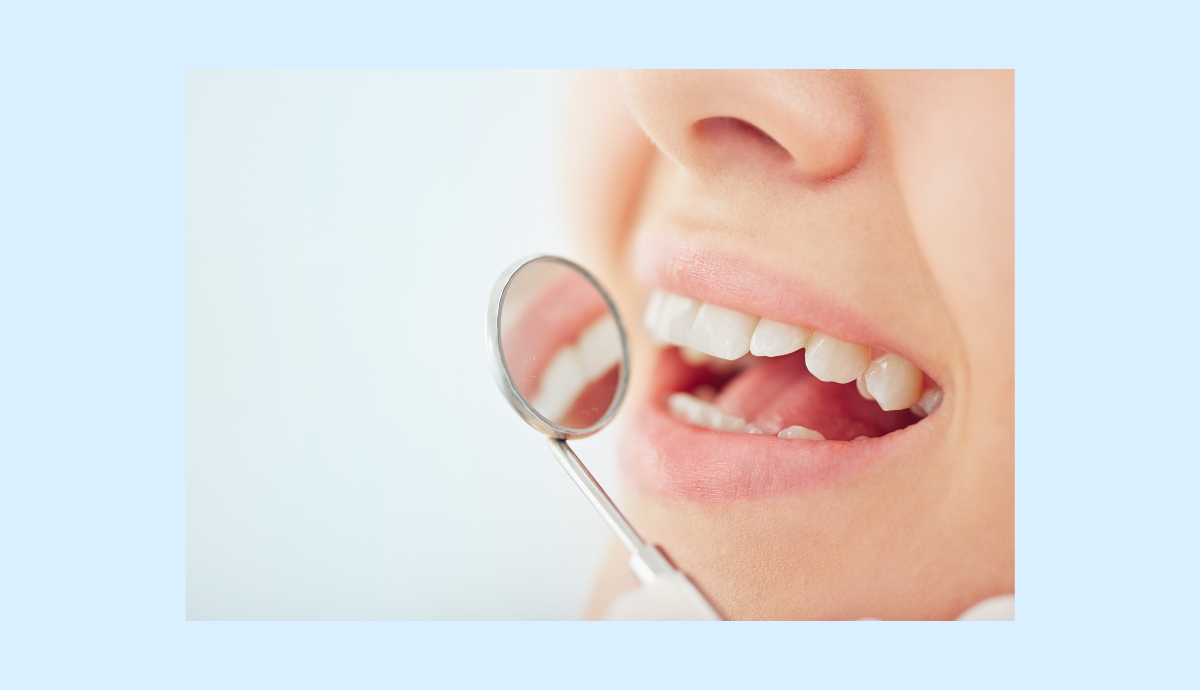 ※写真はイメージです