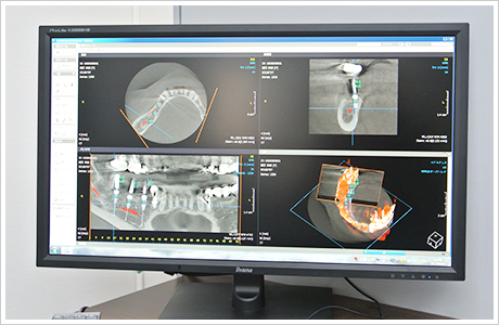 CTやレーザーを活用した丁寧なインプラント治療に注力