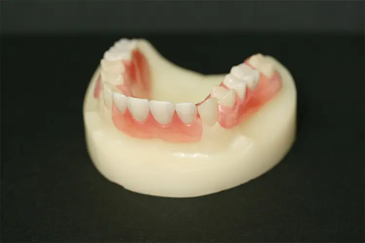 咀嚼機能の回復と自然な見た目を両立する義歯づくりを行っています