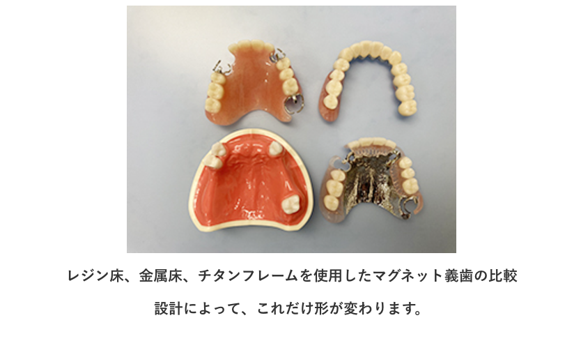 義歯(入れ歯)の治療を通じて、患者様の日常生活の質を高めるお手伝いをしております