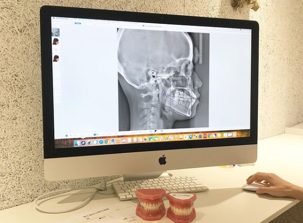 CTスキャンによる3D画像での治療