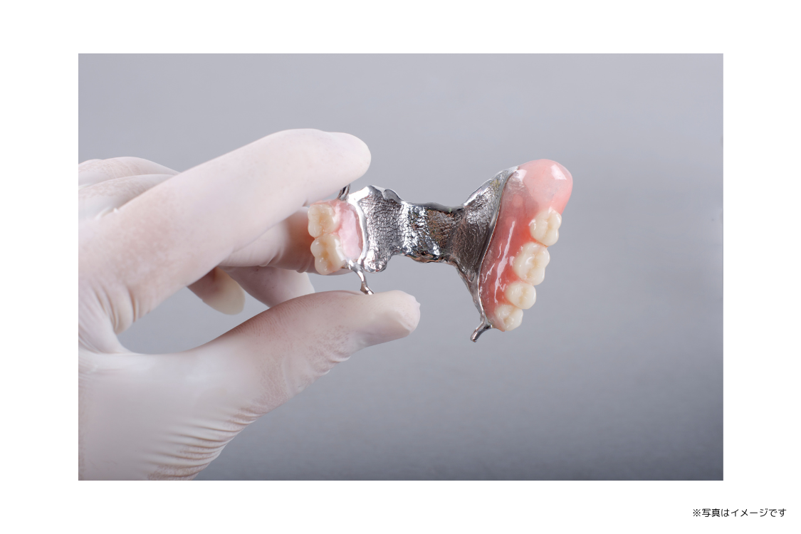 ①歯周病・義歯(入れ歯)でお悩みの方は山崎歯科医院へ ②③イメージ写真