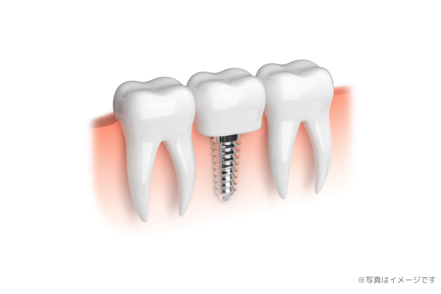 【JR尼崎駅 徒歩7分】訪問診療にも対応し、予防を重視した丁寧な診療を行うきはら歯科