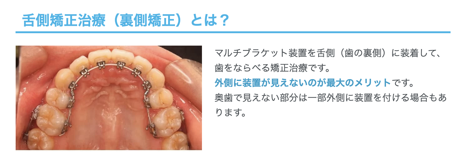 舌側矯正治療(裏側矯正)を提供し、矯正装置が目立たない快適な治療を実現しています