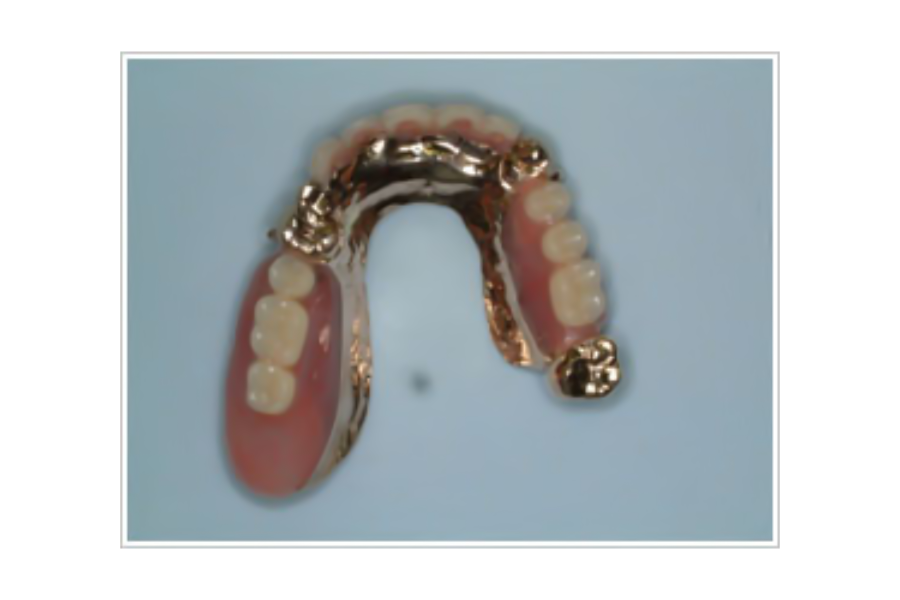 義歯を清潔な状態でご利用いただけます