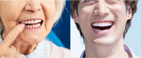 いつまでも若々しい口元を作ります