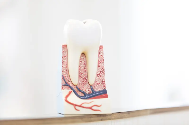 神経まで虫歯が進んでしまった歯に対しても、できる限り天然歯を活かせるように診療が進められています