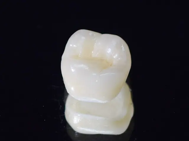 セラミックやジルコニアなど、豊富な素材から選べる治療です