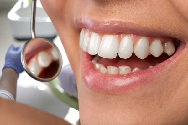 ※画像はイメージです