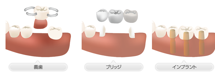 最適な治療法をご提案いたします