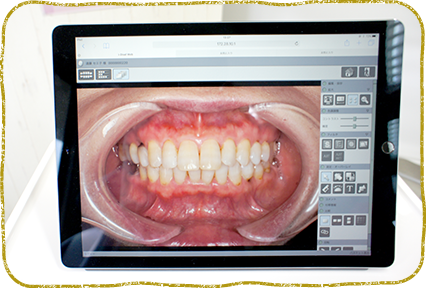 院内技工士との連携で、噛み心地にもこだわった入れ歯を提供
