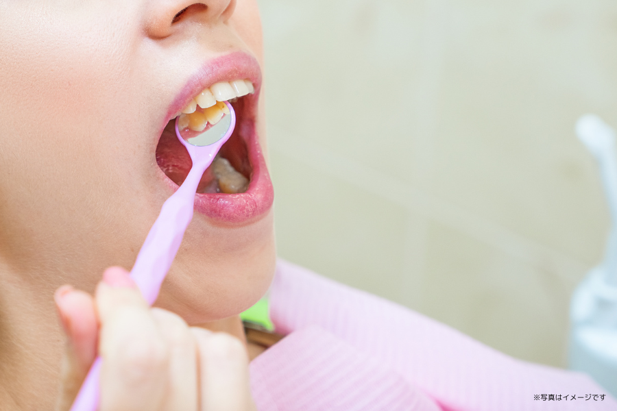 歯周病の原因と予防を丁寧に管理しています