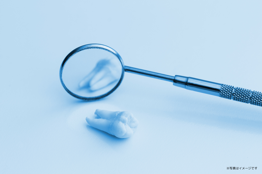 ブラッシング指導で磨き残しを確認しています