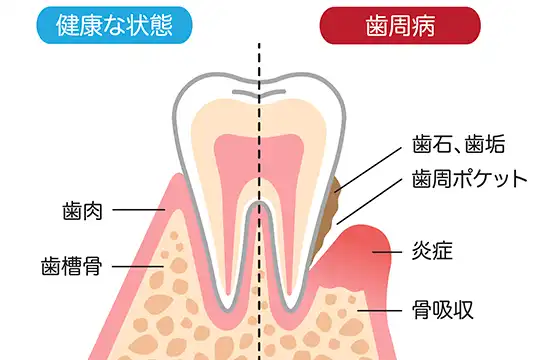 目に見えない“静かな病気”に、しっかり向き合う治療を